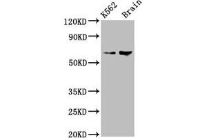 Western Blot Positive WB detected in: K562 whole cell lysate, Rat brain tissue All lanes: BRAP antibody at 7. (BRAP Antikörper  (AA 13-124))