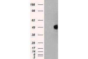 HEK293T cells were transfected with the pCMV6-ENTRY control (Left lane) or pCMV6-ENTRY NTRK2 (Right lane) cDNA for 48 hrs and lysed. (TRKB Antikörper)