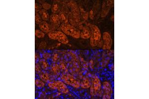 Immunofluorescence analysis of Mouse kidney using MIOX Rabbit pAb (ABIN7268729) at dilution of 1:100. (MIOX Antikörper  (AA 1-285))
