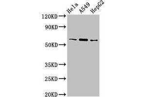 Western Blot Positive WB detected in: Hela whole cell lysate, A549 whole cell lysate, HepG2 whole cell lysate All lanes: TBL1X antibody at 3 μg/mL Secondary Goat polyclonal to rabbit IgG at 1/50000 dilution Predicted band size: 63, 58 kDa Observed band size: 63 kDa (TBL1X Antikörper  (AA 1-300))