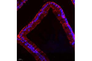 Immunofluorescence (Paraffin-embedded Sections) (IF (p)) image for anti-Myosin Light Chain 6, Alkali, Smooth Muscle and Non Muscle (MYL6) antibody (ABIN7074734)
