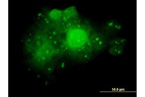 Immunofluorescence of monoclonal antibody to ALDOA on A-431 cell. (ALDOA Antikörper  (AA 1-364))