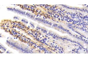 Detection of PIIINP in Mouse Small Intestine Tissue using Polyclonal Antibody to Procollagen III N-Terminal Propeptide (PIIINP) (PIIINP Antikörper  (AA 24-154))