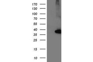 Western Blotting (WB) image for anti-Nudix (Nucleoside Diphosphate Linked Moiety X)-Type Motif 18 (NUDT18) antibody (ABIN1499862) (NUDT18 Antikörper)