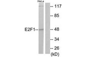 Western blot analysis of extracts from HeLa cells, treated with Etoposide 25uM 24h, using E2F1 (Ab-433) Antibody. (E2F1 Antikörper  (AA 388-437))