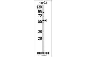 Western blot analysis of anti-DHCR24 Antibody in HepG2 cell line lysates (35ug/lane) (Seladin 1 Antikörper  (N-Term))