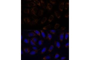 Immunofluorescence analysis of U-2 OS cells using R antibody (ABIN6132582, ABIN6146672, ABIN6146673 and ABIN6222096) at dilution of 1:100. (RAMP1 Antikörper  (AA 27-117))