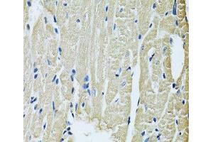 Immunohistochemistry of paraffin-embedded Rat heart using SLC5A6 Polyclonal Antibody at dilution of 1:100 (40x lens). (SLC5A6 Antikörper)