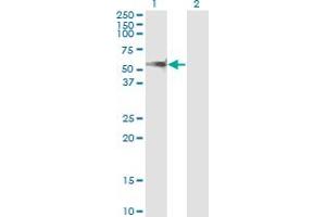 Western Blot analysis of PPM1F expression in transfected 293T cell line by PPM1F monoclonal antibody (M02), clone 1G10. (PPM1F Antikörper  (AA 1-100))