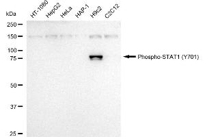 Western blotting analysis using Phospho-STAT1 (Y701) antibody (ABIN7800338).