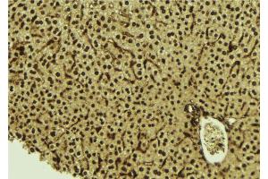 ABIN6277533 at 1/100 staining Mouse liver tissue by IHC-P. (HDGF Antikörper)