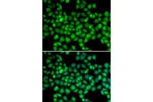 Immunofluorescence analysis of U2OS cells using ARRB2 antibody. (Arrestin 3 Antikörper)