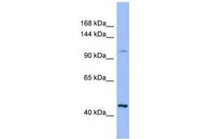 Image no. 1 for anti-Xylosyltransferase II (XYLT2) (AA 575-624) antibody (ABIN6741764) (XYLT2 Antikörper  (AA 575-624))