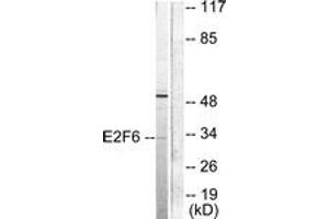 Western Blotting (WB) image for anti-E2F Transcription Factor 6 (E2F6) (AA 141-190) antibody (ABIN2879121) (E2F6 Antikörper  (AA 141-190))