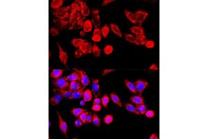 Immunofluorescence analysis of HeLa cells using TRPC6 antibody (ABIN7270918) at dilution of 1:100 (40x lens).