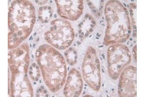 DAB staining on IHC-P;;Samples: Human Kidney Tissue (IDUA Antikörper  (AA 28-306))