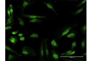 Immunofluorescence of purified MaxPab antibody to RANBP6 on HeLa cell. (RANBP6 Antikörper  (AA 1-1105))