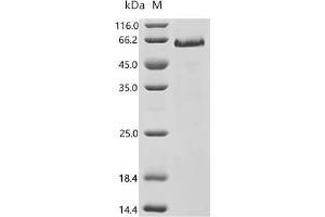 (Tris-Glycine gel) Discontinuous SDS-PAGE (reduced) with 5 % enrichment gel and 15 % separation gel.