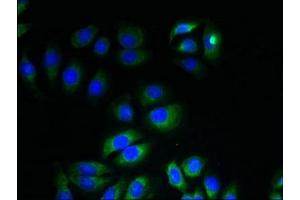 Immunofluorescent analysis of A549 cells using ABIN7156381 at dilution of 1:100 and Alexa Fluor 488-congugated AffiniPure Goat Anti-Rabbit IgG(H+L) (ITM2A Antikörper  (AA 79-263))