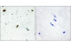 Immunohistochemistry analysis of paraffin-embedded human brain tissue, using ABL1 Antibody. (ABL1 Antikörper  (AA 861-910))