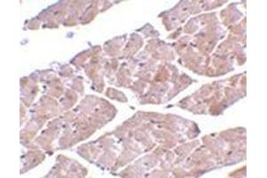 Immunohistochemistry of TRPC3 in mouse heart tissue with this product at 2 μg/ml. (TRPC3 Antikörper  (C-Term))