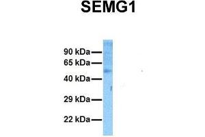 Host:  Rabbit  Target Name:  SEMG1  Sample Tissue:  Human Ovary Tumor  Antibody Dilution:  1.