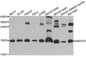 Western blot analysis of extracts of various cell lines, using SNRPD2 antibody. (SNRPD2 Antikörper)