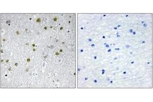 Immunohistochemistry analysis of paraffin-embedded human brain tissue, using NRIP2 Antibody. (NRIP2 Antikörper  (AA 1-50))