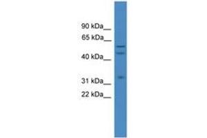 Image no. 1 for anti-ELK1, Member of ETS Oncogene Family (ELK1) (AA 301-350) antibody (ABIN6745314) (ELK1 Antikörper  (AA 301-350))