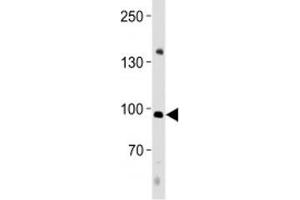 Western Blotting (WB) image for anti-Nuclear Factor of Activated T-Cells, Cytoplasmic, Calcineurin-Dependent 4 (NFATC4) (AA 744-773) antibody (ABIN3032040)