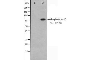Western Blotting (WB) image for anti-conserved Helix-Loop-Helix Ubiquitous Kinase (CHUK) (pSer176), (pSer177) antibody (ABIN6256173)