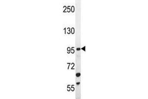 ZGRF1 antibody western blot analysis in mouse Neuro-2a lysate (ZGRF1 Antikörper  (AA 38-66))
