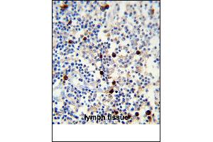 Lambda light chain Antibody (ABIN1539834 and ABIN2843347) immunohistochemistry analysis in formalin fixed and paraffin embedded human lymph tissue followed by peroxidase conjμgation of the secondary antibody and DAB staining. (Lambda-IgLC Antikörper)