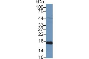 Detection of PRDX5 in Human Hela cell lysate using Polyclonal Antibody to Peroxiredoxin 5 (PRDX5) (Peroxiredoxin 5 Antikörper  (AA 1-162))