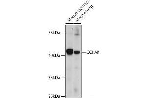 Western blot analysis of extracts of various cell lines using CCKAR Polyclonal Antibody at dilution of 1:1000. (CCKAR Antikörper)