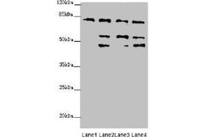Western blot All lanes: ZFYVE1 antibody at 6. (ZFYVE1 Antikörper  (AA 1-280))