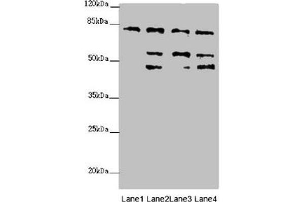 ZFYVE1 Antikörper  (AA 1-280)
