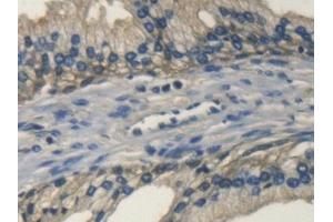 Detection of TH in Human Prostate Tissue using Polyclonal Antibody to Tyrosine Hydroxylase (TH)