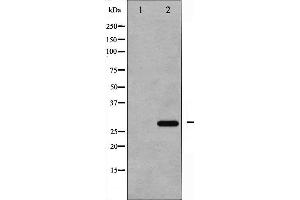 Western blot analysis of p27 Kip1 phosphorylation expression in EGF treated HeLa whole cell lysates,The lane on the left is treated with the antigen-specific peptide. (CDKN1B Antikörper  (pThr187))