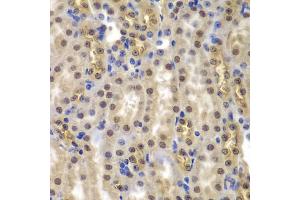 Immunohistochemistry of paraffin-embedded mouse kidney using SMARCB1 antibody (ABIN5973389) at dilution of 1/200 (40x lens). (SMARCB1 Antikörper)