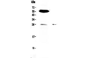 Western blot analysis of CTLA4 using anti-CTLA4 antibody . (CTLA4 Antikörper  (AA 36-161))