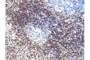 LAT (pY226) staining on tonsil. (LAT Antikörper  (pTyr226))