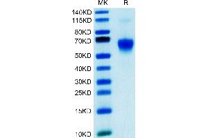 Galectin 9 Protein (AA 2-323) (His tag)