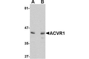 Western blot analysis of ACVR1 in A549 cell lysate with AP30014PU-N ACVR1 antibody at 1 μg/ml in (A) the absence and (B) the presence of blocking peptide. (ACVR1 Antikörper  (N-Term))