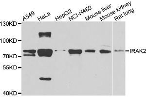 Western blot analysis of extracts of various cell lines, using IRAK2 antibody. (IRAK2 Antikörper)
