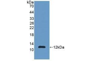Detection of Recombinant S100A11, Human using Polyclonal Antibody to S100 Calcium Binding Protein A11 (S100A11) (S100A11 Antikörper  (AA 1-105))