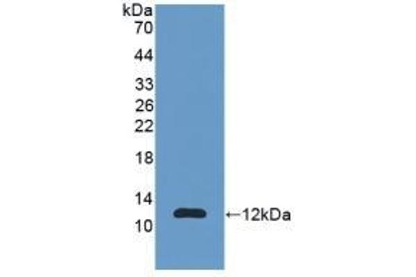 S100A11 抗体  (AA 1-105)