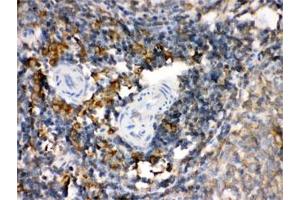 IHC-P: TGM2 antibody testing of rat spleen tissue (Transglutaminase 2 Antikörper)