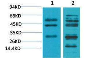 Western Blotting (WB) image for anti-Transforming Growth Factor, beta 1 (TGFB1) antibody (ABIN3181578) (TGFB1 Antikörper)