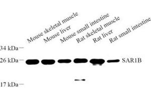 Western blot analysis of SAR1B (ABIN7075507) at dilution of 1: 500
